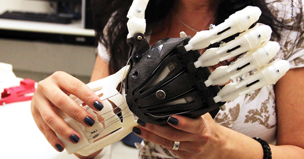 Prótese de mão produzida em uma impressora 3D
